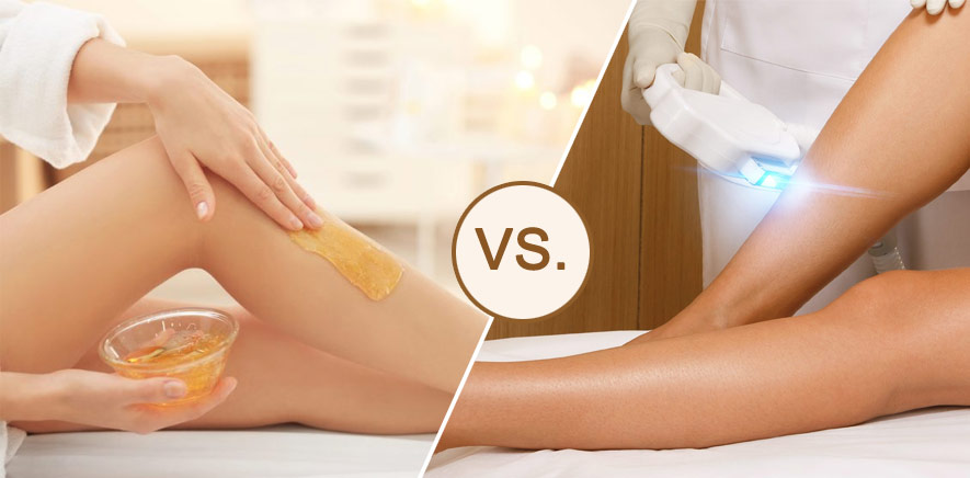 Richmond Hill Laser Hair Removal Versus Waxing